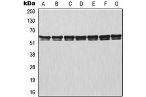 Western blot analysis of TRAF3 expression in MCF7 (A), HeLa (B), Raji (C), NIH3T3 (D), mouse lung (E), rat colon (F), PC12 (G) whole cell lysates. (TRAF3 抗体  (Center))