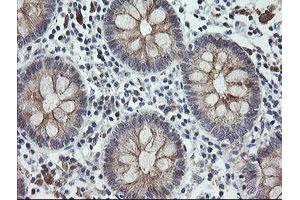 Image no. 7 for anti-Chromosome 2 Open Reading Frame 62 (C2orf62) antibody (ABIN1497054) (C2orf62 抗体)