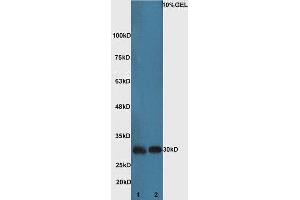 Western Blotting (WB) image for anti-BCL2-Associated Agonist of Cell Death (BAD) (AA 101-204) antibody (ABIN674709)