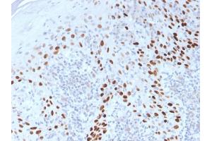 Formalin-fixed, paraffin-embedded Cervix stained with p40 Rabbit Polyclonal Antibody.
