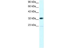 WB Suggested Anti-CBX4 Antibody Titration: 0. (CBX4 抗体  (N-Term))