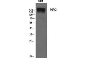 Western Blot (WB) analysis of NIH-3T3 cells using CD206 Polyclonal Antibody. (Macrophage Mannose Receptor 1 抗体  (Internal Region))