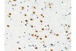 ABIN6257236 and ABIN6275800 at 1/100 staining Rat brain tissue by IHC-P.