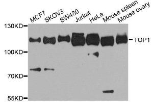 Western blot analysis of extracts of various cell lines, using TOP1 antibody. (Topoisomerase I 抗体  (AA 1-100))