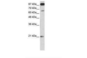 Image no. 2 for anti-Nuclear Factor of Activated T-Cells, Cytoplasmic, Calcineurin-Dependent 4 (NFATC4) (AA 601-650) antibody (ABIN202948) (NFATC4 抗体  (AA 601-650))