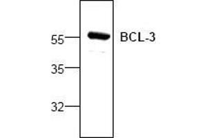 Image no. 1 for anti-B-Cell CLL/lymphoma 3 (BCL3) antibody (ABIN127088) (BCL3 抗体)