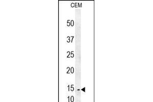 CRCT1 Antibody (N-term) (ABIN653986 and ABIN2843928) western blot analysis in CEM cell line lysates (35 μg/lane). (CRCT1 抗体  (N-Term))