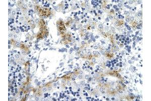 Immunohistochemistry (IHC) image for anti-Topoisomerase (DNA) II alpha 170kDa (TOP2A) (C-Term) antibody (ABIN2792181)