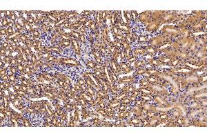 Detection of NME2 in Mouse Kidney Tissue using Polyclonal Antibody to Non Metastatic Cells 2, Protein NM23B Expressed In (NME2) (NME2 抗体  (AA 8-149))