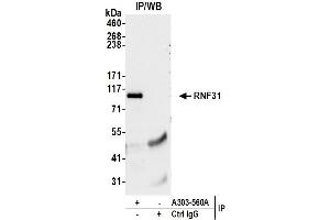 Immunoprecipitation (IP) image for anti-Ring Finger Protein 31 (RNF31) (AA 1022-1072) antibody (ABIN7449808) (RNF31 抗体  (AA 1022-1072))
