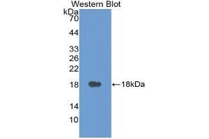 Western blot analysis of the recombinant protein. (VEGFA 抗体  (AA 27-145))