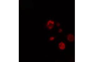 ABIN6274288 staining NIH-3T3 cells by IF/ICC. (LIMK2 抗体  (Internal Region))