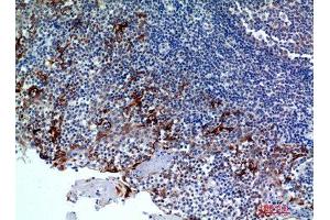 Immunohistochemistry (IHC) analysis of paraffin-embedded Human Tonsils2, antibody was diluted at 1:100. (CMTM8 抗体)