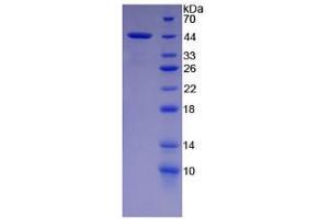 SDS-PAGE analysis of Rat Cholecystokinin Protein. (Cholecystokinin Protein (CCK))