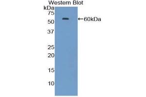Western blot analysis of the recombinant protein. (HSP70 1A 抗体  (AA 1-641))
