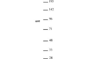 Western Blotting (WB) image for anti-Nuclear Receptor Subfamily 3, Group C, Member 1 (Glucocorticoid Receptor) (NR3C1) antibody (ABIN6972447)