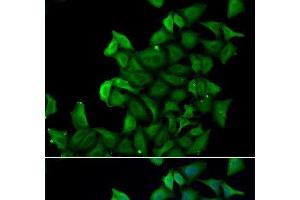 Immunofluorescence analysis of A549 cells using FABP5 Polyclonal Antibody (FABP5 抗体)