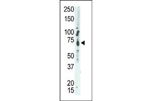 Western Blotting (WB) image for anti-Protein tyrosine Phosphatase, Non-Receptor Type 9 (PTPN9) (AA 477-505), (C-Term) antibody (ABIN392827)