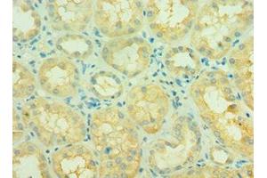 Immunohistochemistry (IHC) image for anti-Sirtuin 3 (SIRT3) (AA 20-130) antibody (ABIN7160859)