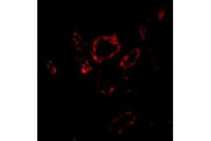 Immunofluorescence of SNAI2 in human kidney tissue with SNAI2 polyclonal antibody  at 20 ug/mL . (SLUG 抗体  (Internal Region))