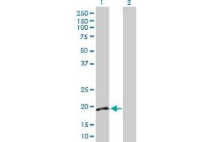 Western Blot analysis of IFNA16 expression in transfected 293T cell line by IFNA16 MaxPab polyclonal antibody. (IFNA16 抗体  (AA 1-189))