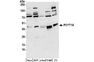 Western Blotting (WB) image for anti-Phosphate Cytidylyltransferase 1, Choline, alpha (PCYT1A) (AA 1-50) antibody (ABIN7454584)