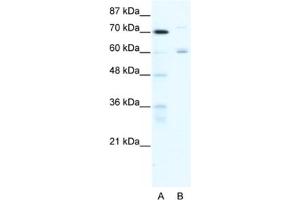 Western Blotting (WB) image for anti-Forkhead Box J2 (FOXJ2) antibody (ABIN2460610) (Forkhead Box J2 抗体)