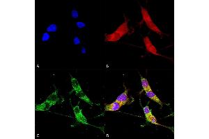 Immunocytochemistry (ICC) image for anti-Solute Carrier Family 17 (Vesicular Glutamate Transporter), Member 6 (SLC17A6) (AA 501-582) antibody (Atto 488) (ABIN2483734)