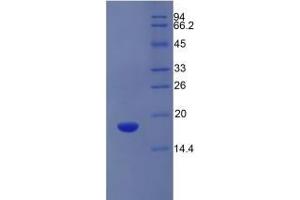 SDS-PAGE of Protein Standard from the Kit (Highly purified E. (SLC3A2 ELISA 试剂盒)
