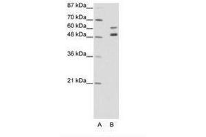 Image no. 1 for anti-Zinc Finger Protein 682 (ZNF682) (AA 35-84) antibody (ABIN202663) (ZNF682 抗体  (AA 35-84))