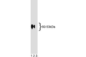 Western blot analysis of EBP50 on human endothelial cell lysate. (SLC9A3R1 抗体  (AA 128-249))