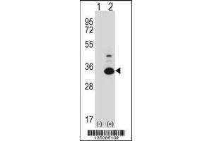 Western blot analysis of Tp53rk using rabbit polyclonal Mouse Tp53rk Antibody using 293 cell lysates (2 ug/lane) either nontransfected (Lane 1) or transiently transfected (Lane 2) with the Tp53rk gene. (TP53RK 抗体  (AA 100-128))