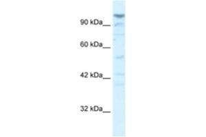 Western Blotting (WB) image for anti-La Ribonucleoprotein Domain Family, Member 1B (LARP1B) antibody (ABIN2460977) (LARP1B 抗体)
