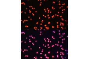 Immunofluorescence analysis of C6 cells using ZNF581 Polyclonal Antibody (ABIN6128960, ABIN6150520, ABIN6150521 and ABIN6217055) at dilution of 1:100 (40x lens). (ZNF581 抗体  (AA 1-90))