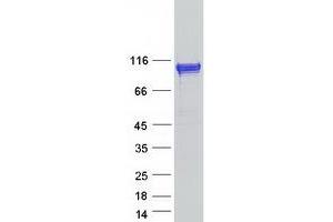 Western Blotting (WB) image for RAB GTPase Activating Protein 1-Like (RABGAP1L) (Transcript Variant 1) protein (Myc-DYKDDDDK Tag) (ABIN2730261)