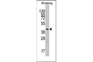 Western blot analysis of anti-TBRG1 Pab in mouse kidney tissue lysates (35ug/lane). (TBRG1 抗体  (N-Term))
