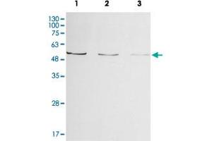 Western blot analysis of Enpp2 from zebrafish embryo lysate by Enpp2 polyclonal antibody ( Cat # PAB8520 ) (1:500, 4°C, overnight).
