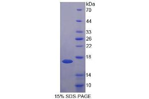 SDS-PAGE analysis of Human UQCRB Protein. (UQCRB 蛋白)