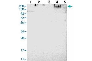 Western blot analysis of Lane 1: RT-4, Lane 2: U-251 MG, Lane 3: Human Plasma, Lane 4: Liver, Lane 5: Tonsil with SPTBN1 polyclonal antibody . (SPTBN1 抗体)