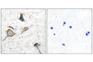 Immunohistochemistry (IHC) image for anti-Matrix Metallopeptidase 16 (Membrane-inserted) (MMP16) (C-Term) antibody (ABIN1848679) (MMP16 抗体  (C-Term))