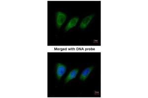 ICC/IF Image Immunofluorescence analysis of paraformaldehyde-fixed HeLa, using protein kinase N2, antibody at 1:200 dilution. (PKN2 抗体)