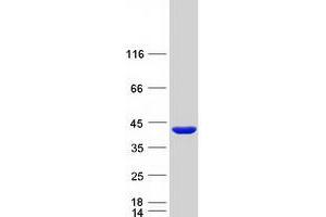 Western Blotting (WB) image for GIPC PDZ Domain Containing Family, Member 1 (GIPC1) (Transcript Variant 5) protein (Myc-DYKDDDDK Tag) (ABIN2721885)