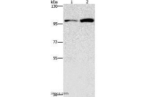 Western blot analysis of HepG2 and K562 cell, using CDC27 Polyclonal Antibody at dilution of 1:750 (CDC27 抗体)