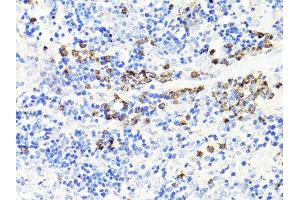 Immunohistochemistry of paraffin-embedded rat spleen using S100A9 antibody. (S100A9 抗体)