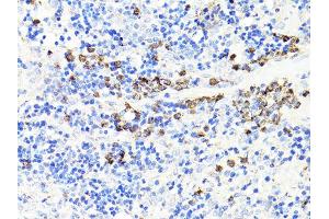 Immunohistochemistry of paraffin-embedded rat spleen using S100A9 antibody.