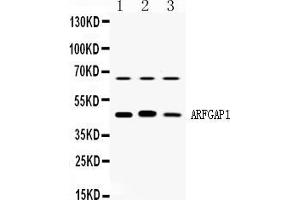 Western blot analysis of ARFGAP1 expression in rat brain extract ( Lane 1), mouse brain extract ( Lane 2) and HELA whole cell lysates ( Lane 3). (ARFGAP1 抗体  (AA 1-183))