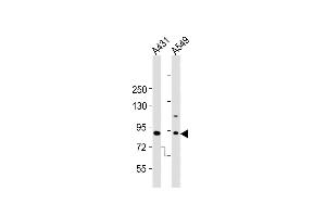 All lanes : Anti-Dnmt3b Antibody  at 1:2000 dilution Lane 1: A431 whole cell lysates Lane 2: A549 whole cell lysates Lysates/proteins at 20 μg per lane. (DNMT3B 抗体  (AA 389-417))