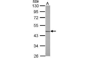 Western Blotting (WB) image for anti-Succinate-CoA Ligase, GDP-Forming, beta Subunit (SUCLG2) antibody (ABIN2856470)