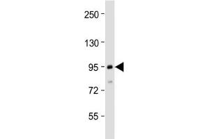 Western blot testing of human MCF7 cell lysate with TGFBR3 antibody at 1:2000. (TGFBR3 抗体  (N-Term))