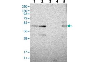 Western blot analysis of Lane 1: RT-4, Lane 2: U-251 MG, Lane 3: Human Plasma, Lane 4: Liver, Lane 5: Tonsil with ZNF397OS polyclonal antibody  at 1:250-1:500 dilution. (ZSCAN30 抗体)